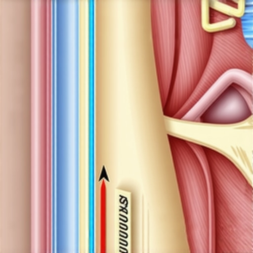 Diagram of C5-C6 disc herniation showing the difference between muscle stretching and nerve irritation.